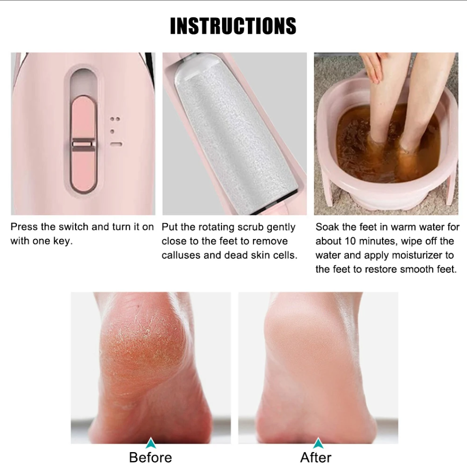 🌸 Rechargeable Electric Foot File & Callus Remover