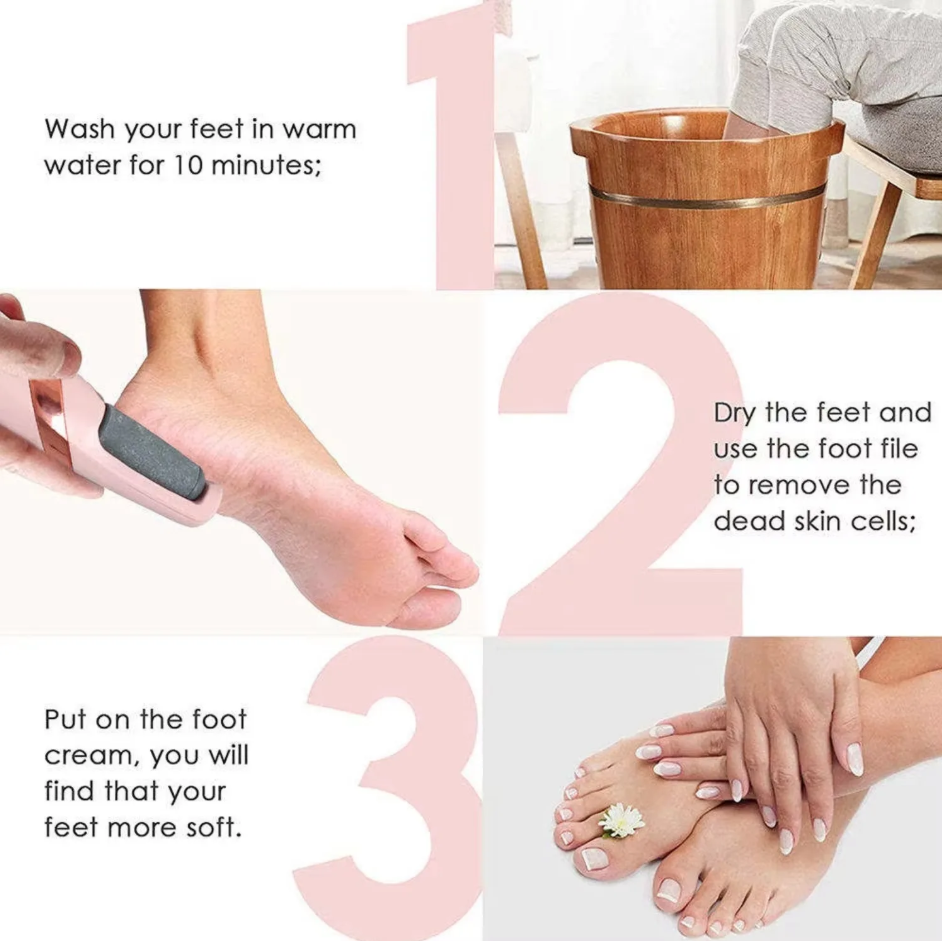 🌸 Rechargeable Electric Foot File & Callus Remover
